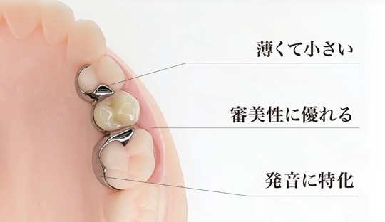 葛飾区小岩の歯医者 細田歯科医院｜入れ歯（義歯）治療について